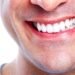 Descubre los consejos para lograr dientes blancos y eliminar las manchas